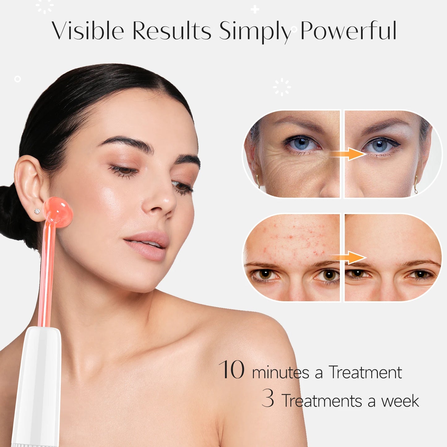 Darsonval Glow Wand – Acne & Anti-Aging Tool